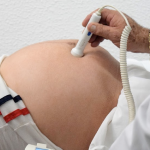 Study shows a decline in maternal deaths in states with pro-life laws