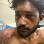Christian Teen Beaten for Protecting Women in Pakistan Christian Teen Beaten for Protecting Women in Pakistan
